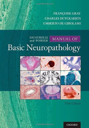 Escourolle & Poirier’s Manual of Basic Neuropathology, 5e (Original PDF from Publisher) 1 | Medical Books & CME Courses escourolle poiriers manual of basic neuropathology 5e original pdf from publisher 6356a99c26f54 | Medical Books & CME Courses