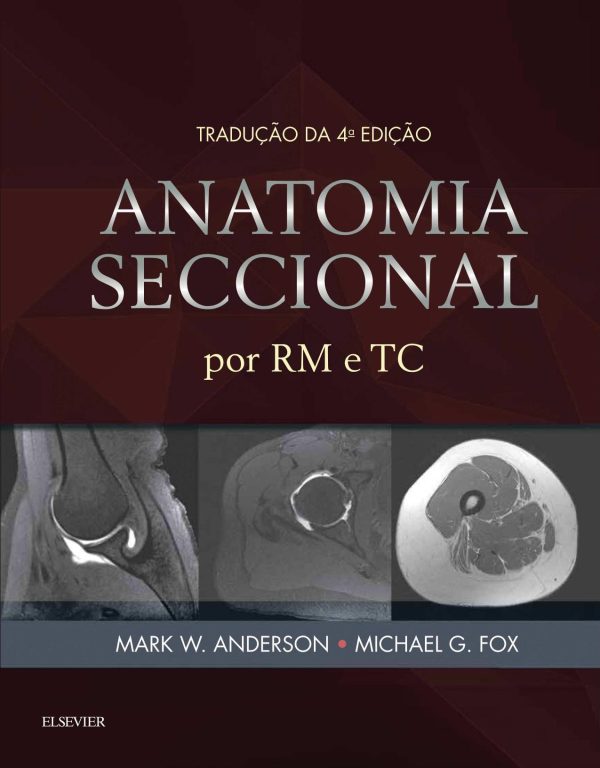 anatomia seccional por rm e tc pdf 63873738557a3 | Medical Books & CME Courses