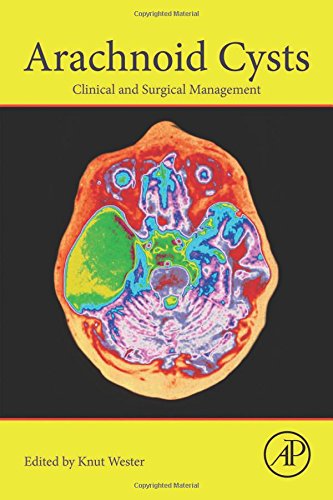Arachnoid Cysts: Clinical and Surgical Management (EPUB) 2 | Medical Books & CME Courses arachnoid cysts clinical and surgical management epub 6386d8ed35983 | Medical Books & CME Courses