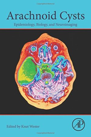 Arachnoid Cysts: Epidemiology, Biology, and Neuroimaging (EPUB)