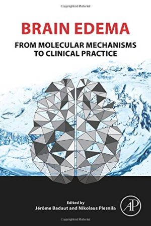 Brain Edema: From Molecular Mechanisms to Clinical Practice (PDF)