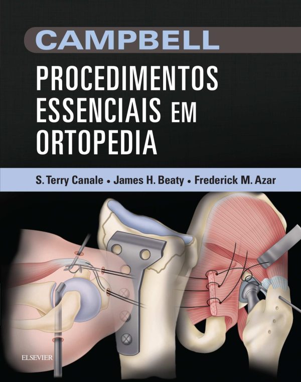 campbell procedimentos essenciais em ortopedia portugues pdf 6387364ac5980 | Medical Books & CME Courses