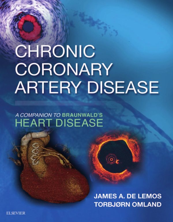 chronic coronary artery disease a companion to braunwalds heart disease e book 1st edition pdf 638730559e7aa | Medical Books & CME Courses