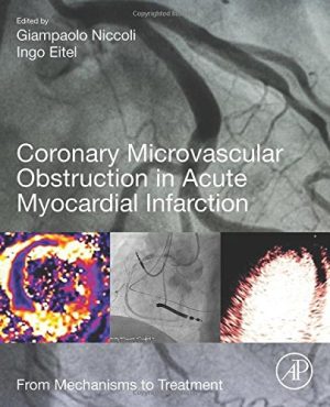 Coronary Microvascular Obstruction in Acute Myocardial Infarction: From Mechanisms to Treatment (PDF)