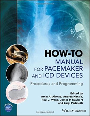 How-to Manual for Pacemaker and ICD Devices: Procedures and Programming (PDF)