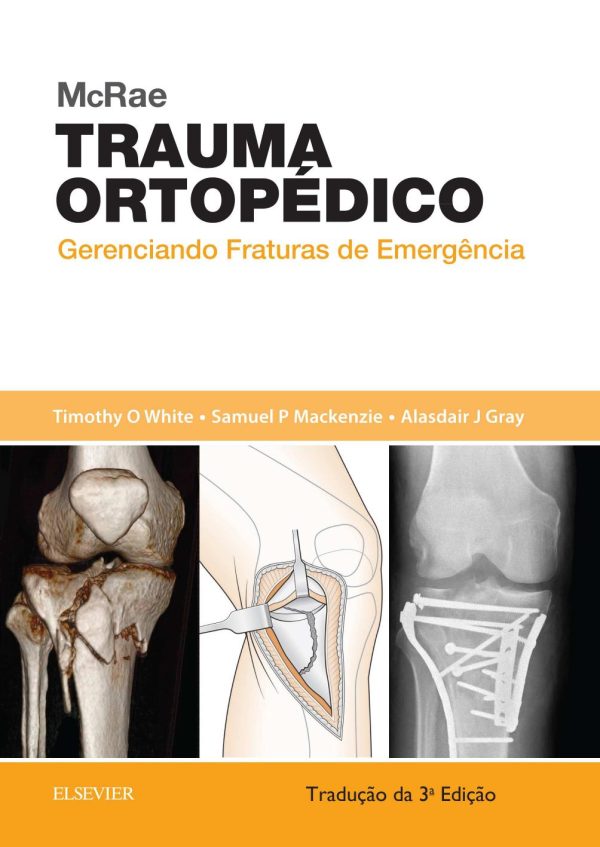 mcrae trauma ortopedico portuguese brazilian pdf 638738c614572 | Medical Books & CME Courses