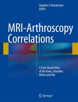 MRI-Arthroscopy Correlations: A Case-Based Atlas of the Knee, Shoulder, Elbow and Hip (EPUB)