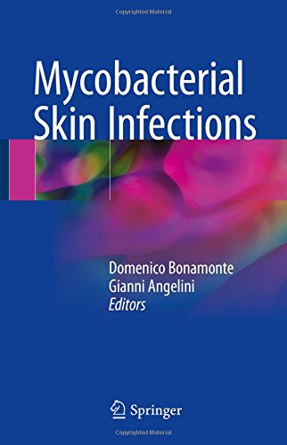 Mycobacterial Skin Infections (PDF) 2 | Medical Books & CME Courses mycobacterial skin infections pdf 63833f58706e3 | Medical Books & CME Courses