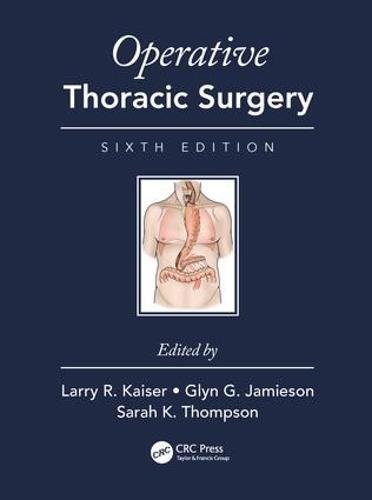 Operative Thoracic Surgery, Sixth Edition (EPUB) 2 | Medical Books & CME Courses operative thoracic surgery sixth edition epub 6386e35dc118c | Medical Books & CME Courses