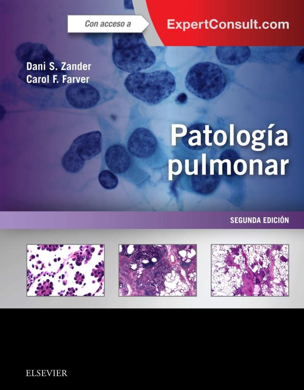 patologia pulmonar expertconsult spanish edition pdf 6387369ee6b21 | Medical Books & CME Courses