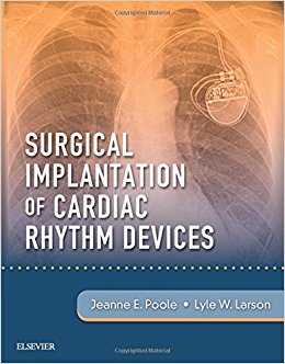 Surgical Implantation of Cardiac Rhythm Devices, 1e (PDF)
