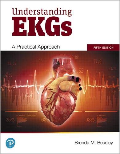 Understanding EKGs: A Practical Approach (5th Edition) (Original PDF from Publisher) 2 | Medical Books & CME Courses understanding ekgs a practical approach 5th edition original pdf from publisher 6387e60a350e3 | Medical Books & CME Courses