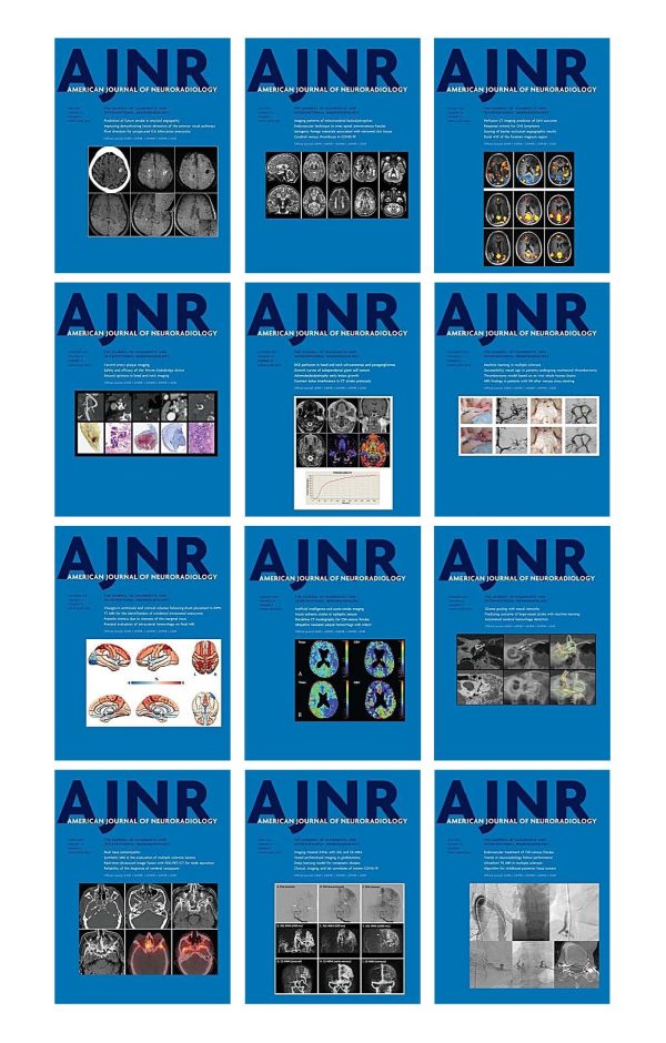 american journal of neuroradiology 2021 full archives true pdf 63a1a0b968279 | Medical Books & CME Courses