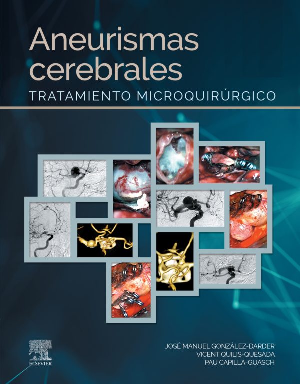 aneurismas cerebrales tratamiento microquirurgico original pdf from publisher 63a1f25c61a3f | Medical Books & CME Courses