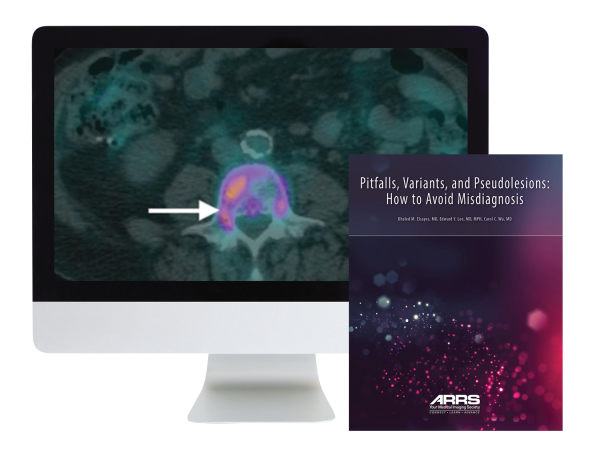 arrs pitfalls variants and pseudolesions how to avoid misdiagnosis 2019 cme videos 638cf6f61bdf4 | Medical Books & CME Courses