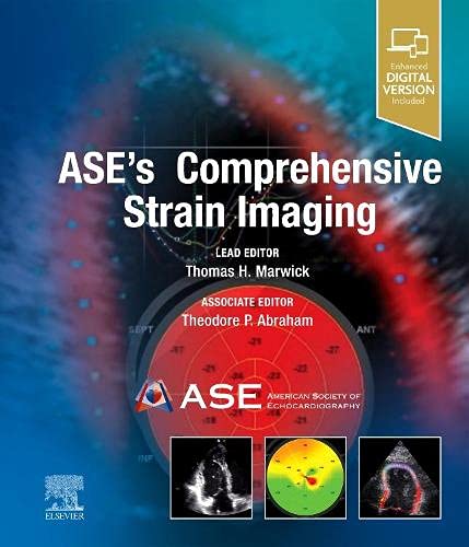 ASE’s Comprehensive Strain Imaging (Videos) 2 | Medical Books & CME Courses ases comprehensive strain imaging videos 63a089465d774 | Medical Books & CME Courses