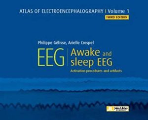Atlas of Electroencephalography. Awake and sleep EEG. Activation procedures and artifacts Vol 1 (Original PDF from Publisher)