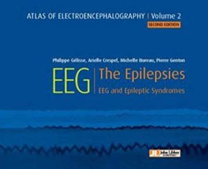 Atlas of electroencephalography:The Epilepsies. EEG and epileptic syndromes Vol 2 (ePub+Converted PDF)