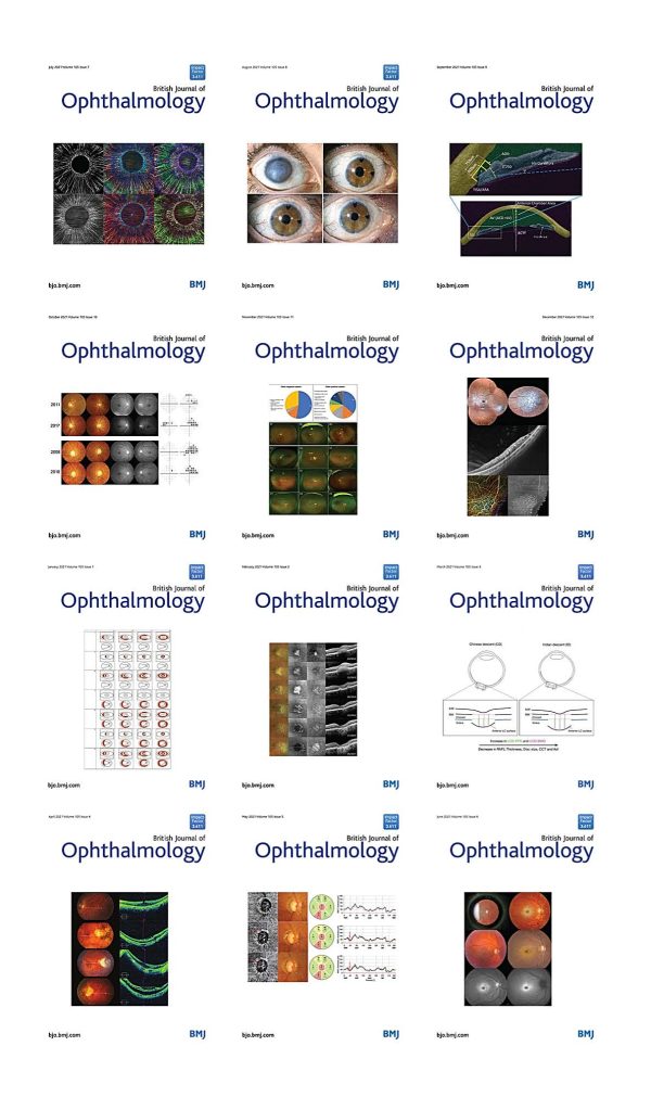 british journal of ophthalmology 2021 full archives true pdf 63a19978c111f | Medical Books & CME Courses