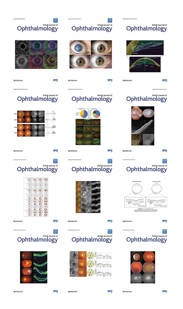 British Journal Of Ophthalmology 2021 Full Archives (True PDF ...