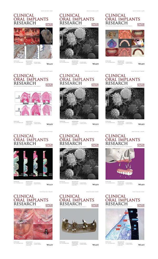 clinical oral implants research 2021 full archives true pdf 63a19fddd4193 | Medical Books & CME Courses