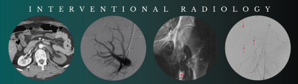 cme science interventional radiology stephen t kee m d 2021 cme videos 63a093e35e40d | Medical Books & CME Courses