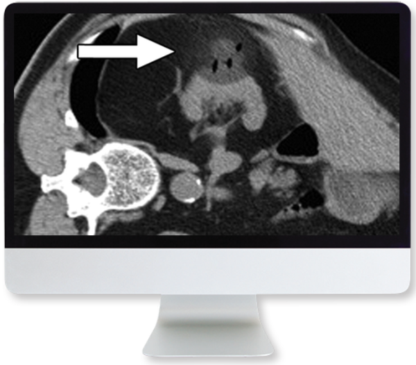 cross sectional renal imaging techniques and diagnosis 2020 cme videos 638d3e2911a65 | Medical Books & CME Courses