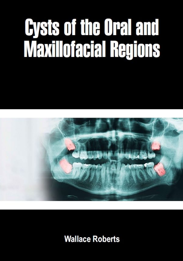 cysts of the oral and maxillofacial regions original pdf from publisher 638c899f36b37 | Medical Books & CME Courses