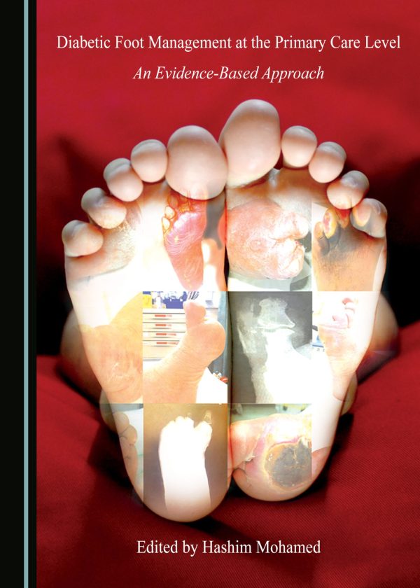 diabetic foot management at the primary care level original pdf from publisher 63a01765232cf | Medical Books & CME Courses