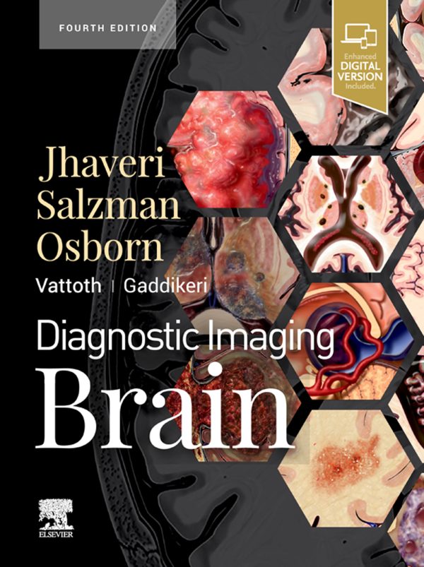 diagnostic imaging brain 4th edition epubvideos 638d27d5eb9e9 | Medical Books & CME Courses