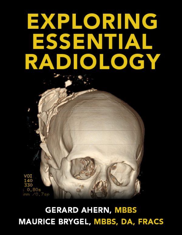 exploring essential radiology videos 63a0411fef0db | Medical Books & CME Courses