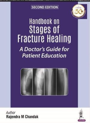 Handbook on Stages of Fracture Healing: A Doctor’s Guide for Patient Education, 2nd Edition (Original PDF from Publisher)
