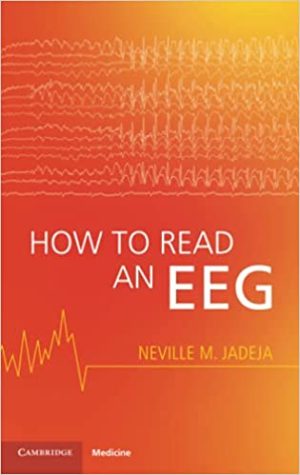 How to Read an EEG (Original PDF from Publisher)
