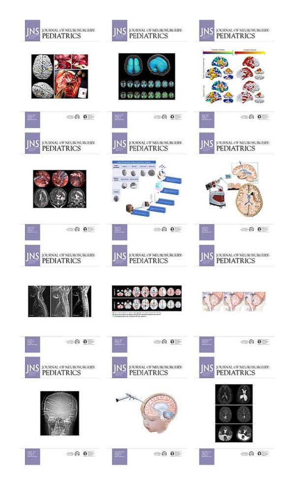 journal of neurosurgery pediatrics 2021 full archives true pdf 63a1979eea7ac | Medical Books & CME Courses