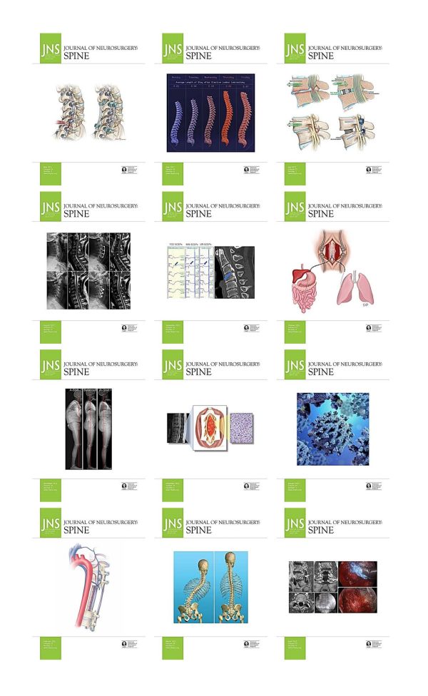 journal of neurosurgery spine 2021 full archives true pdf 63a19a2fc0833 | Medical Books & CME Courses