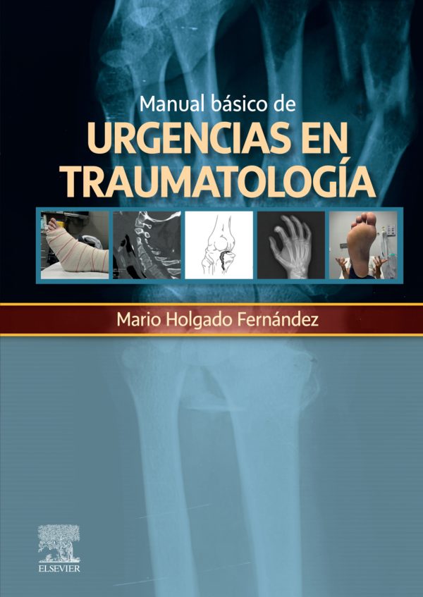 manual basico de urgencias en traumatologia original pdf from publisher 63a1f2a1d2cd0 | Medical Books & CME Courses