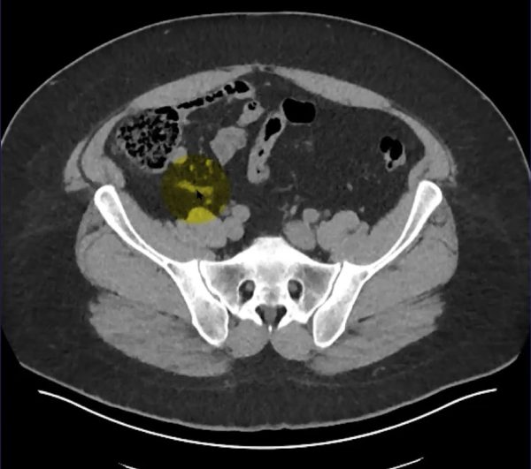 mrionline imaging mastery series appendix 2021 cme videos 63a14dbc402f2 | Medical Books & CME Courses