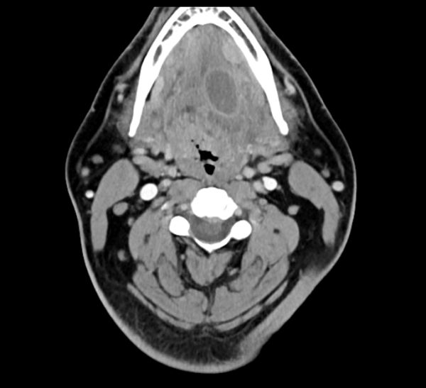 mrionline imaging mastery series pathology of the oral cavity and oropharynx 2020 cme videos 63a163f22a4ae | Medical Books & CME Courses