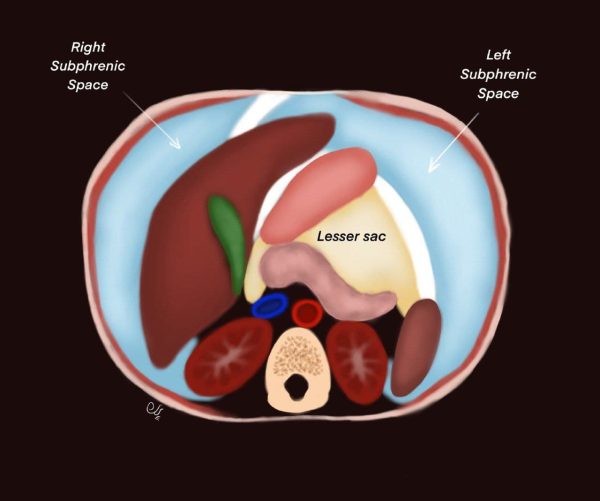 mrionline imaging mastery series peritoneum and mesentery 2021 cme videos 63a169a9ce9e3 | Medical Books & CME Courses