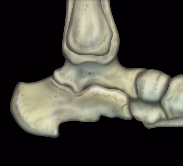 mrionline mri mastery series ankle 2017 cme videos 63a132baa3784 | Medical Books & CME Courses