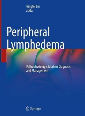Peripheral Lymphedema: Pathophysiology, Modern Diagnosis and Management (Original PDF from Publisher)