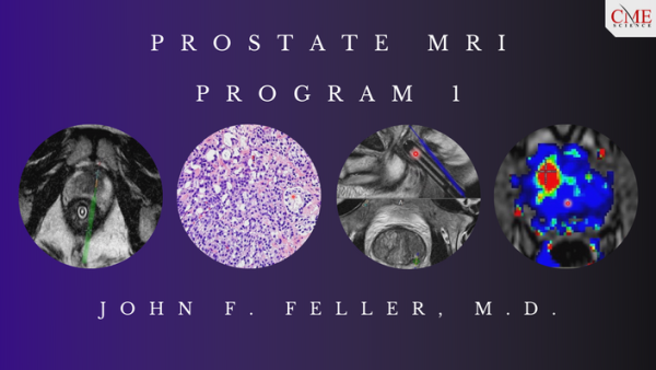 prostate mri program 1 john f feller m d cmescience cme videos 63a0e3efb0b0a | Medical Books & CME Courses