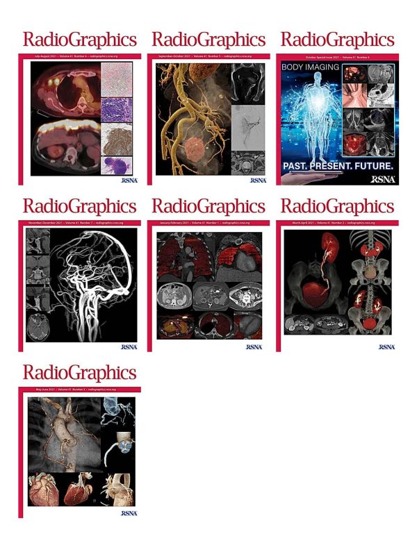 radiographics 2021 full archives true pdf 63a1a457f0078 | Medical Books & CME Courses