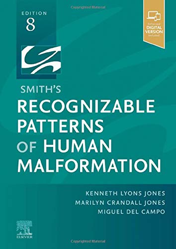 Smith’s Recognizable Patterns of Human Malformation, 8th edition (Original PDF from Publisher) 2 | Medical Books & CME Courses smiths recognizable patterns of human malformation 8th edition original pdf from publisher 63a0170e7e1f3 | Medical Books & CME Courses