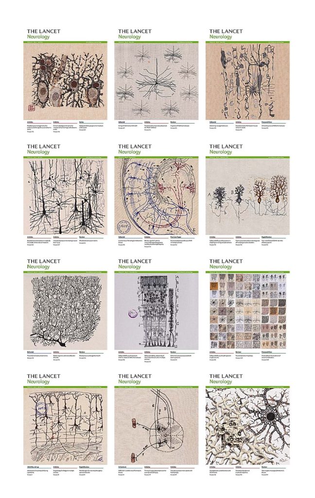 The Lancet Neurology 2021 Full Archives (True PDF) Medical Books