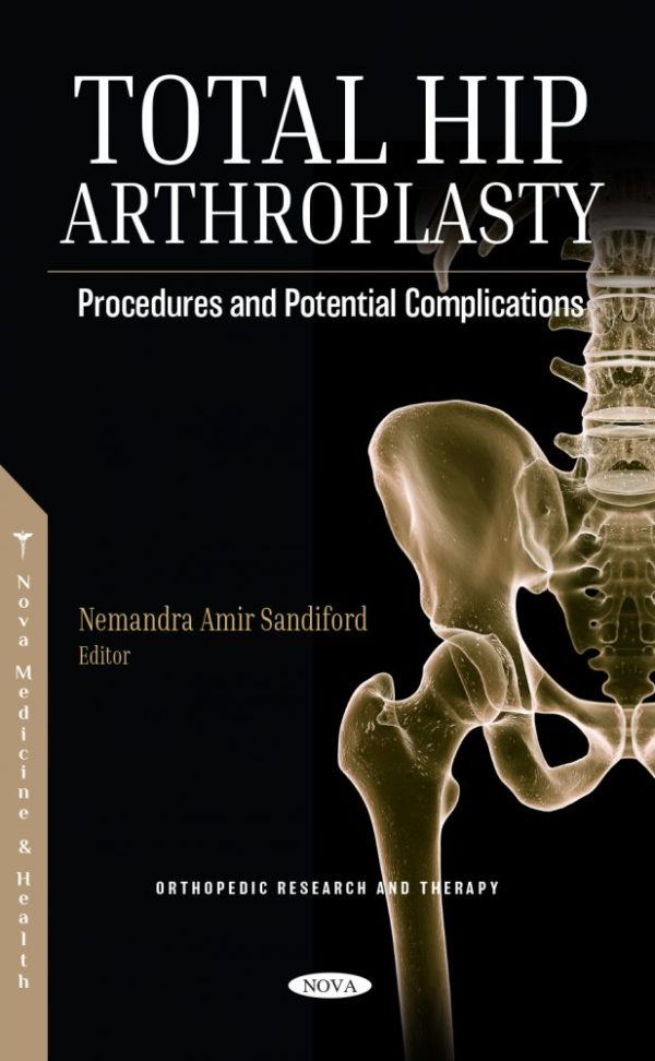 total hip arthroplasty procedures and potential complications original pdf from publisher 63a1db8ae2101 | Medical Books & CME Courses