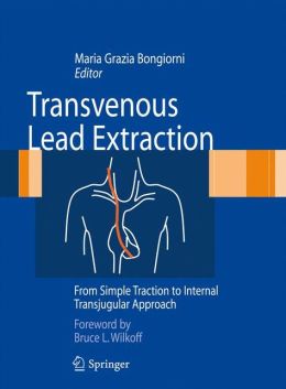 Transvenous Lead Extraction: From Simple Traction to Internal Transjugular Approach (EPUB)