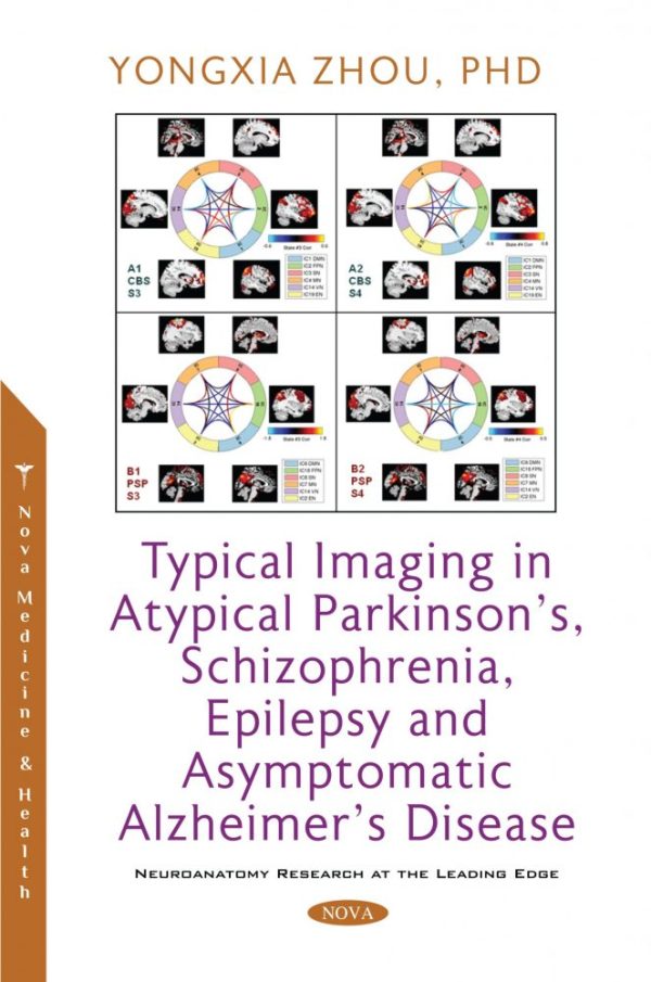 typical imaging in atypical parkinsons schizophrenia epilepsy and asymptomatic alzheimers disease original pdf from publisher 63a0d4d3b8663 | Medical Books & CME Courses