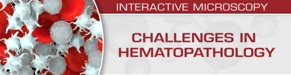 uscap challenges in hematopathology 2019 cme videos 638cff6679e64 | Medical Books & CME Courses