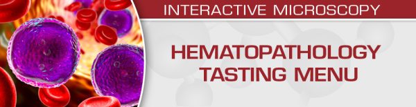 uscap hematopathology tasting menu a sampling of delightful diagnostic challenges 2021 cme videos 63a19b806402d | Medical Books & CME Courses